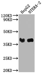 Western Blot Positive WB detected in: HepG2 whole cell lysate, NTERA-2 whole cell lysate All lanes: LCMT1 antibody at 1:2000 Secondary Goat polyclonal to rabbit IgG at 1/50000 dilution Predicted band size: 39, 42, 33 kDa Observed band size: 39 kDa