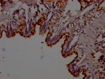IHC image of CSB-PA012816LA01RA diluted at 1:200 and staining in paraffin-embedded rat lung tissue performed on a Leica BondTM system. After dewaxing and hydration, antigen retrieval was mediated by high pressure in a citrate buffer (pH 6.0). Sect...