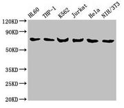 Western Blot Positive WB detected in: HL60 whole cell lysate, THP-1 whole cell lysate, K562 whole cell lysate, Jurkat whole cell lysate, Hela whole cell lysate, NIH/3T3 whole cell lysate All lanes: LCP1 antibody at 8µg/ml Secondary Goat polyclonal...