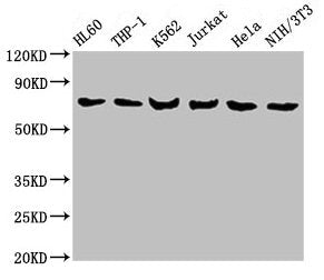 Western Blot Positive WB detected in: HL60 whole cell lysate, THP-1 whole cell lysate, K562 whole cell lysate, Jurkat whole cell lysate, Hela whole cell lysate, NIH/3T3 whole cell lysate All lanes: LCP1 antibody at 8µg/ml Secondary Goat polyclonal...
