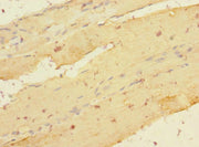 Immunohistochemistry of paraffin-embedded human skeletal muscle tissue using CSB-PA012831ESR2HU at dilution of 1:100