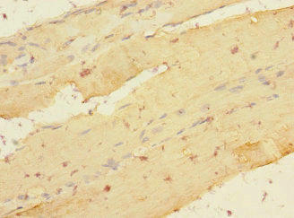 Immunohistochemistry of paraffin-embedded human skeletal muscle tissue using CSB-PA012831ESR2HU at dilution of 1:100
