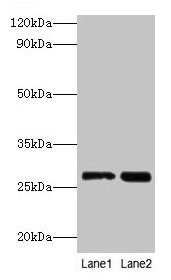 Western blot All lanes: LGALS3 antibody at 2µg/ml Lane 1: Hela whole cell lysate Lane 2: MCF-7 whole cell lysate Secondary Goat polyclonal to rabbit IgG at 1/10000 dilution Predicted band size: 27 kDa Observed band size: 27 kDa