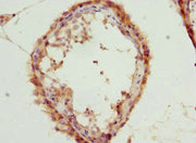 Immunohistochemistry of paraffin-embedded human testis tissue using CSB-PA012894ESR2HU at dilution of 1:100
