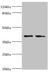 Western blot All lanes: LGALS9 antibody at 14ug/ml Lane 1: Hela whole cell lysate Lane 2: Jurkat whole cell lysate Secondary Goat polyclonal to rabbit IgG at 1/10000 dilution Predicted band size: 40, 36, 35, 27, 26, 39 kDa Observed band size: 40 kDa