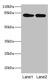 Western blot All lanes: LHCGR antibody at 2µg/ml Lane 1: Mouse brain tissue Lane 2: Mouse kidney tissue Secondary Goat polyclonal to rabbit IgG at 1/10000 dilution Predicted band size: 79, 72 kDa Observed band size: 79 kDa