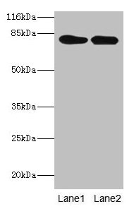 Western blot All lanes: LHCGR antibody at 2µg/ml Lane 1: Mouse brain tissue Lane 2: Mouse kidney tissue Secondary Goat polyclonal to rabbit IgG at 1/10000 dilution Predicted band size: 79, 72 kDa Observed band size: 79 kDa
