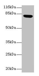 Western blot All lanes: Lhcgr antibody at 2µg/ml + Rat gonadal tissue Secondary Goat polyclonal to rabbit IgG at 1/10000 dilution Predicted band size: 79, 35, 38, 73, 28, 33, 21, 72, 31, 34, 41 kDa Observed band size: 79 kDa