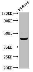 Western Blot Positive WB detected in: Rat kidney tissue All lanes: LHX2 antibody at 5.43ug/ml Secondary Goat polyclonal to rabbit IgG at 1/50000 dilution Predicted band size: 45 kDa Observed band size: 45 kDa