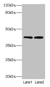 Western blot All lanes: LIAS antibody at 2µg/ml Lane 1: MCF-7 whole cell lysate Lane 2: K562 whole cell lysate Secondary Goat polyclonal to rabbit IgG at 1/10000 dilution Predicted band size: 42, 37, 38 kDa Observed band size: 42 kDa