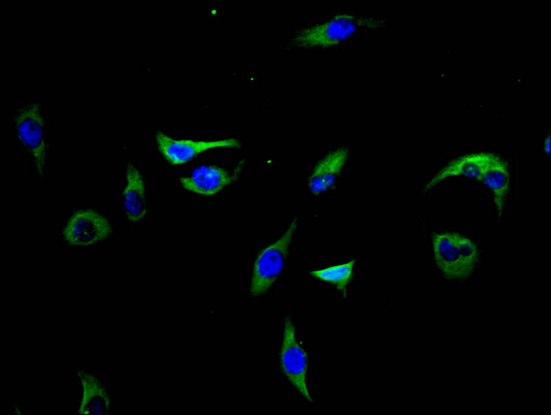 Immunofluorescence staining of A549 cells with CSB-PA012929LA01HU at 1:200, counter-stained with DAPI. The cells were fixed in 4% formaldehyde, permeabilized using 0.2% Triton X-100 and blocked in 10% normal Goat Serum. The cells were then incubat...