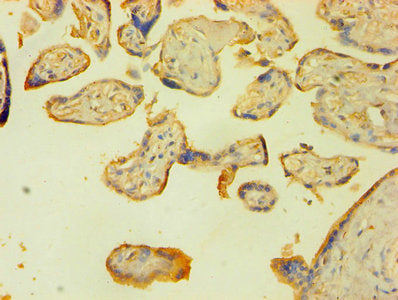 Immunohistochemistry of paraffin-embedded human placenta tissue using CSB-PA012930YA01HU at dilution of 1:100