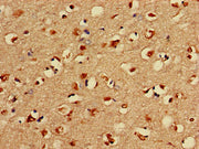 Immunohistochemistry of paraffin-embedded human brain tissue using CSB-PA012952LA01HU at dilution of 1:100