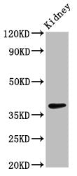 Western Blot Positive WB detected in: Rat kidney tissue All lanes: LIMS1 antibody at 2.7ug/ml Secondary Goat polyclonal to rabbit IgG at 1/50000 dilution Predicted band size: 38, 39, 45, 42 kDa Observed band size: 38 kDa