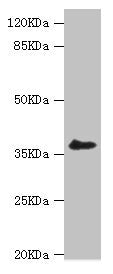 Western blot All lanes: LIMS1 antibody at 0.93ug/ml + A549 whole cell lysate Secondary Goat polyclonal to rabbit IgG at 1/10000 dilution Predicted band size: 38, 39, 45, 42 kDa Observed band size: 38 kDa