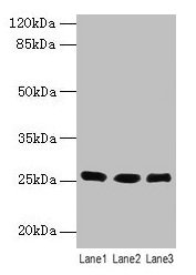 Western blot All lanes: LIN7A antibody at 6µg/ml Lane 1: Human placenta tissue Lane 2: Mouse kidney tissue Lane 3: Mouse liver tissue Secondary Goat polyclonal to rabbit IgG at 1/10000 dilution Predicted band size: 26 kDa Observed band size: 26 kDa