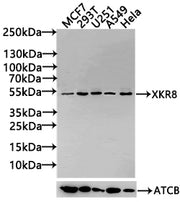 Western Blot Positive WB detected in: MCF7 whole cell lysate(30µg), 293T whole cell lysate(30µg), U251 whole cell lysate(30µg), A549 whole cell lysate(30µg), Hela whole cell lysate(30µg) All lanes: LIPA antibody at 1:1000 Secondary Goat polyclonal...