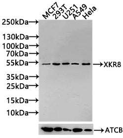 Western Blot Positive WB detected in: MCF7 whole cell lysate(30µg), 293T whole cell lysate(30µg), U251 whole cell lysate(30µg), A549 whole cell lysate(30µg), Hela whole cell lysate(30µg) All lanes: LIPA antibody at 1:1000 Secondary Goat polyclonal...