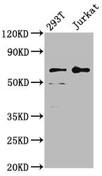 Western Blot Positive WB detected in: 293T whole cell lysate, Jurkat whole cell lysate All lanes: LILRB2 antibody at 4µg/ml Secondary Goat polyclonal to rabbit IgG at 1/50000 dilution Predicted band size: 66, 65, 56, 52 kDa Observed band size: 66 kDa