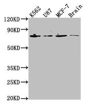 Western Blot Positive WB detected in: K562 whole cell lysate, U87 whole cell lysate, MCF-7 whole cell lysate, Rat brain tissue All lanes: LMNA antibody at 1:2000 Secondary Goat polyclonal to rabbit IgG at 1/50000 dilution Predicted band size: 75,...