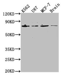 Western Blot Positive WB detected in: K562 whole cell lysate, U87 whole cell lysate, MCF-7 whole cell lysate, Rat brain tissue All lanes: LMNA antibody at 1:2000 Secondary Goat polyclonal to rabbit IgG at 1/50000 dilution Predicted band size: 75,...