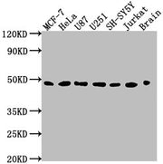 Western Blot Positive WB detected in: MCF-7 whole cell lysate, HeLa whole cell lysate, U87 whole cell lysate, U251 whole cell lysate, SH-SY5Y whole cell lysate, Jurkat whole cell lysate, Rat brain tissue All lanes: LOX antibody at 1:2000 Secondary...