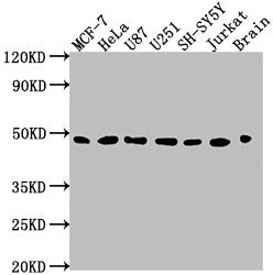 Western Blot Positive WB detected in: MCF-7 whole cell lysate, HeLa whole cell lysate, U87 whole cell lysate, U251 whole cell lysate, SH-SY5Y whole cell lysate, Jurkat whole cell lysate, Rat brain tissue All lanes: LOX antibody at 1:2000 Secondary...