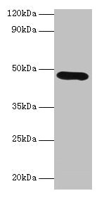 Western blot All lanes: Lox antibody at 2µg/ml + K562 whole cell lysate Secondary Goat polyclonal to rabbit IgG at 1/10000 dilution Predicted band size: 47 kDa Observed band size: 47 kDa
