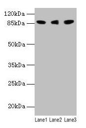 Western blot All lanes: Loxl2 antibody at 14µg/ml Lane 1: 293T whole cell lysate Lane 2: A549 whole cell lysate Lane 3: A431 whole cell lysate Secondary Goat polyclonal to rabbit IgG at 1/10000 dilution Predicted band size: 88, 82 kDa Observed ban...