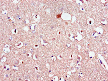 Immunohistochemistry of paraffin-embedded human brain tissue using CSB-PA013047LA01HU at dilution of 1:100