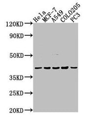 Western Blot Positive WB detected in: Hela whole cell lysate, MCF-7 whole cell lysate, A549 whole cell lysate, COLO205 whole cell lysate, PC-3 whole cell lysate All lanes: LPAR2 antibody at 1:2000 Secondary Goat polyclonal to rabbit IgG at 1/50000...