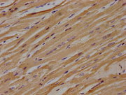 IHC image of CSB-PA013049OA01HU diluted at 1:100 and staining in paraffin-embedded human heart tissue performed on a Leica BondTM system. After dewaxing and hydration, antigen retrieval was mediated by high pressure in a citrate buffer (pH 6.0). S...