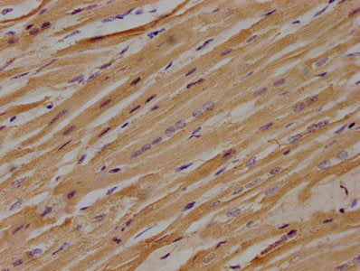 IHC image of CSB-PA013049OA01HU diluted at 1:100 and staining in paraffin-embedded human heart tissue performed on a Leica BondTM system. After dewaxing and hydration, antigen retrieval was mediated by high pressure in a citrate buffer (pH 6.0). S...