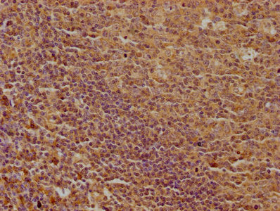 IHC image of CSB-PA013051OA01HU diluted at 1:100 and staining in paraffin-embedded human tonsil tissue performed on a Leica BondTM system. After dewaxing and hydration, antigen retrieval was mediated by high pressure in a citrate buffer (pH 6.0)....