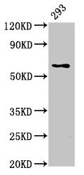 Western Blot Positive WB detected in: 293 whole cell lysate All lanes: LPCAT2 antibody at 5ug/ml Secondary Goat polyclonal to rabbit IgG at 1/50000 dilution Predicted band size: 61, 31 kDa Observed band size: 61 kDa