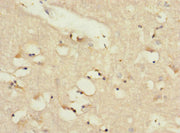 Immunohistochemistry of paraffin-embedded human brain tissue using CSB-PA013060ESR2HU at dilution of 1:100