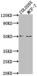 Western Blot Positive WB detected in: COLO205 whole cell lysate, MCF-7 whole cell lysate All lanes: LRAT antibody at 1:2000 Secondary Goat polyclonal to rabbit IgG at 1/50000 dilution Predicted band size: 26 kDa Observed band size: 50 kDa