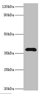 Western blot All lanes: Leucine-rich alpha-2-glycoprotein antibody at 4ug/ml + HepG2 whole cell lysate Secondary Goat polyclonal to rabbit IgG at 1/10000 dilution Predicted band size: 38 kDa Observed band size: 38 kDa