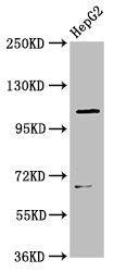 Western Blot Positive WB detected in: HepG2 whole cell lysate All lanes: LRIG2 antibody at 3.5ug/ml Secondary Goat polyclonal to rabbit IgG at 1/50000 dilution Predicted band size: 119 kDa Observed band size: 119 kDa