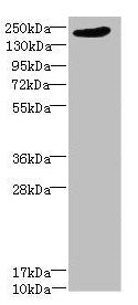 Western blot All lanes: LRP4 antibody at 1.39µg/ml + PC-3 whole cell lysate Secondary Goat polyclonal to rabbit IgG at 1/10000 dilution Predicted band size: 213 kDa Observed band size: 213 kDa