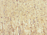 Immunohistochemistry of paraffin-embedded human adrenal gland tissue using CSB-PA013099ESR2HU at dilution of 1:100