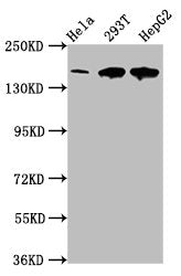 Western Blot Positive WB detected in: Hela whole cell lysate, 293T whole cell lysate, HepG2 whole cell lysate All lanes: LRPPRC antibody at 4µg/ml Secondary Goat polyclonal to rabbit IgG at 1/50000 dilution Predicted band size: 158 kDa Observed ba...