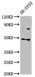 Western Blot Positive WB detected in: SH-SY5Y whole cell lysate All lanes: CSNK1E antibody at 3µg/ml Secondary Goat polyclonal to rabbit IgG at 1/50000 dilution Predicted band size: 48 kDa Observed band size: 48 kDa