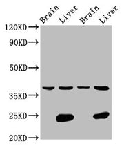 Western Blot Positive WB detected in: Rat brain tissue, Rat liver tissue, Mouse brain tissue, Mouse liver tissue All lanes: LSAMP antibody at 4.2ug/ml Secondary Goat polyclonal to rabbit IgG at 1/50000 dilution Predicted band size: 38 kDa Observed...