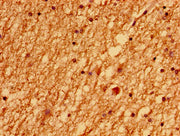 Immunohistochemistry of paraffin-embedded human brain tissue using CSB-PA013199LA01HU at dilution of 1:100
