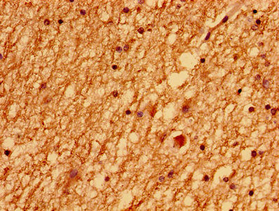Immunohistochemistry of paraffin-embedded human brain tissue using CSB-PA013199LA01HU at dilution of 1:100