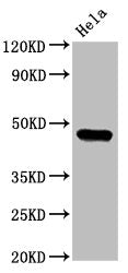 Western Blot Positive WB detected in: Hela whole cell lysate All lanes: CSNK1E antibody at 3.2µg/ml Secondary Goat polyclonal to rabbit IgG at 1/50000 dilution Predicted band size: 48 kDa Observed band size: 48 kDa