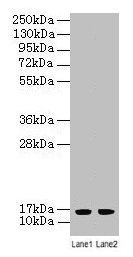 Western blot All lanes: LSM4 antibody at 2µg/ml Lane 1: A549 whole cell lysate Lane 2: K562 whole cell lysate Secondary Goat polyclonal to rabbit IgG at 1/10000 dilution Predicted band size: 16 kDa Observed band size: 16 kDa