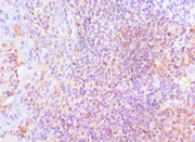 Immunohistochemistry of paraffin-embedded human tonsil tissue using CSB-PA013214DSR1HU at dilution of 1:100