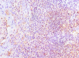 Immunohistochemistry of paraffin-embedded human tonsil tissue using CSB-PA013214DSR1HU at dilution of 1:100